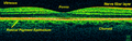 Retina-OCT800.png