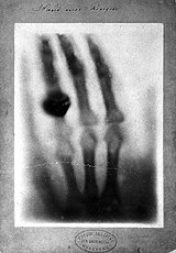 Radiograph of hand by W.K. Roentgen Wellcome L0000622EB.jpg
