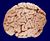 Brain 090407.jpg