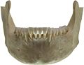Human jawbone front.jpg