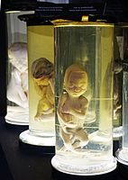 Human fetus.jpg